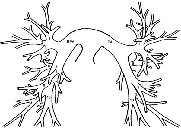 Arbre artériel pulmonaire — segments numérotés (RPA/LPA)